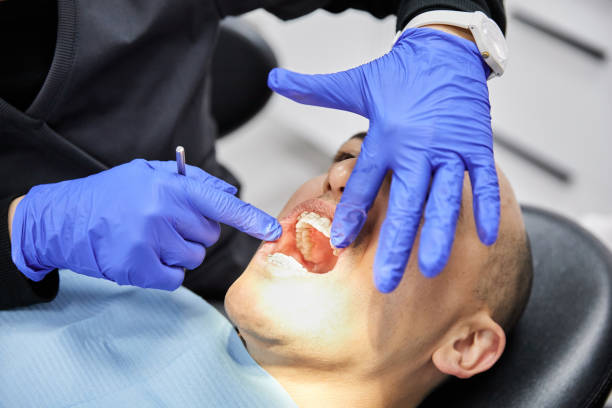 Best Emergency Treatment for Dental Infections or Abscesses in Lakewood, SC